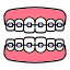 Braces