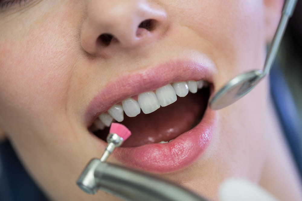 Dental Crown