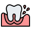 Dental Veneers
