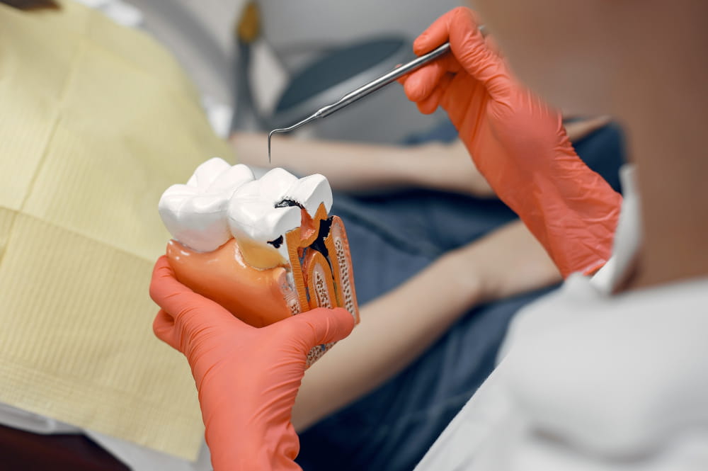 Root Canal